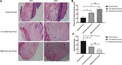 Effects of <mark class="highlighted">Api</mark>genin Treatment on Random Skin Flap Survival in Rats